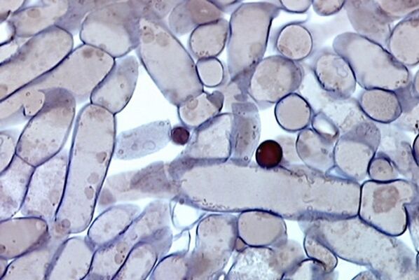 клетки од габа на ноктите под микроскоп