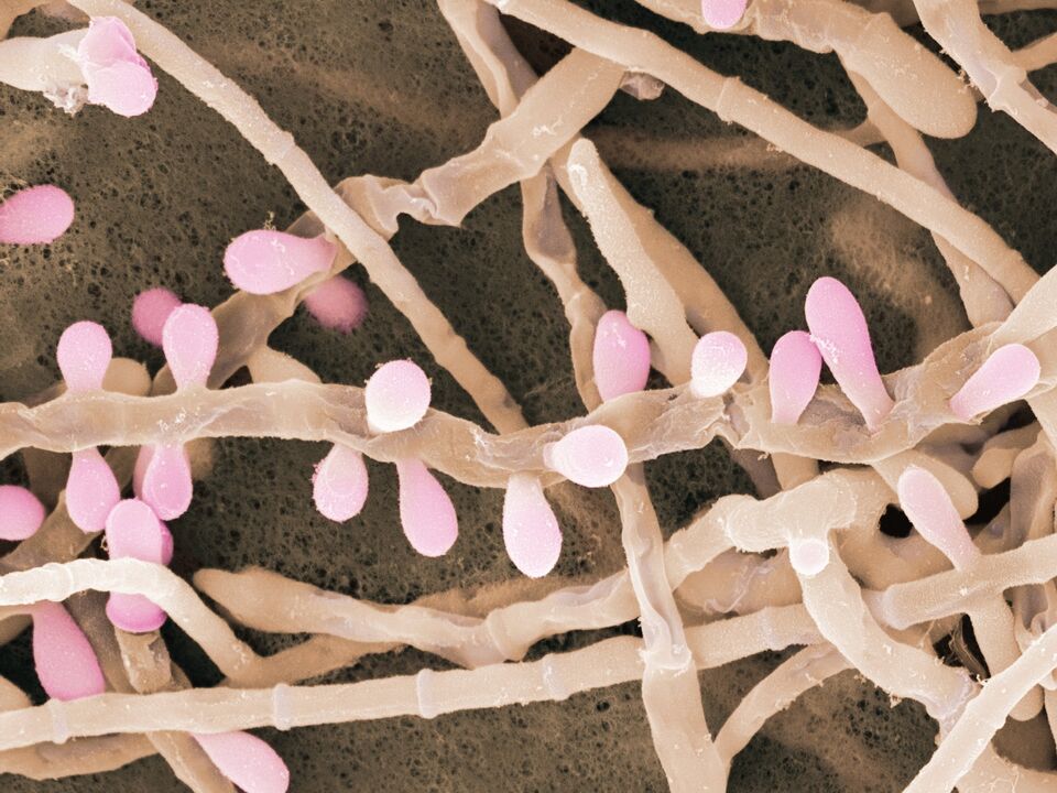 Trichophyton rubrum е вид на габа која влијае на кожата на стапалата.
